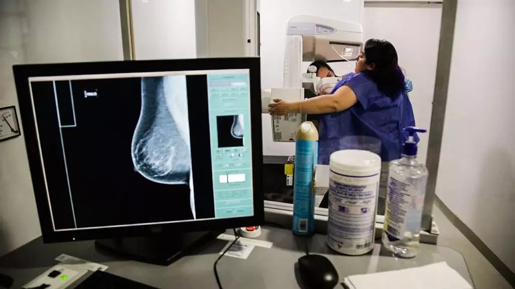 Cáncer de Mama